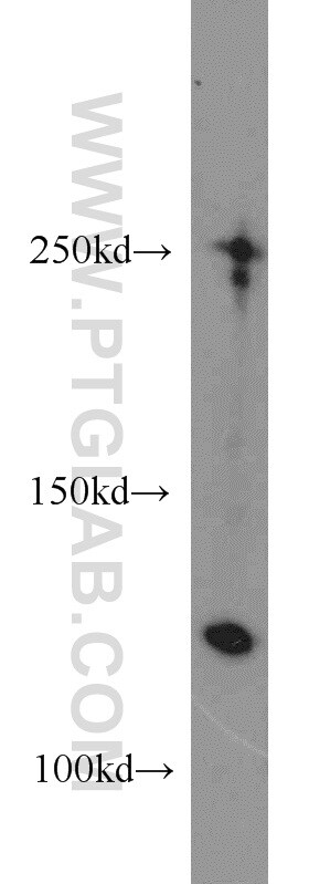 Collagen Type I Antibody Ap