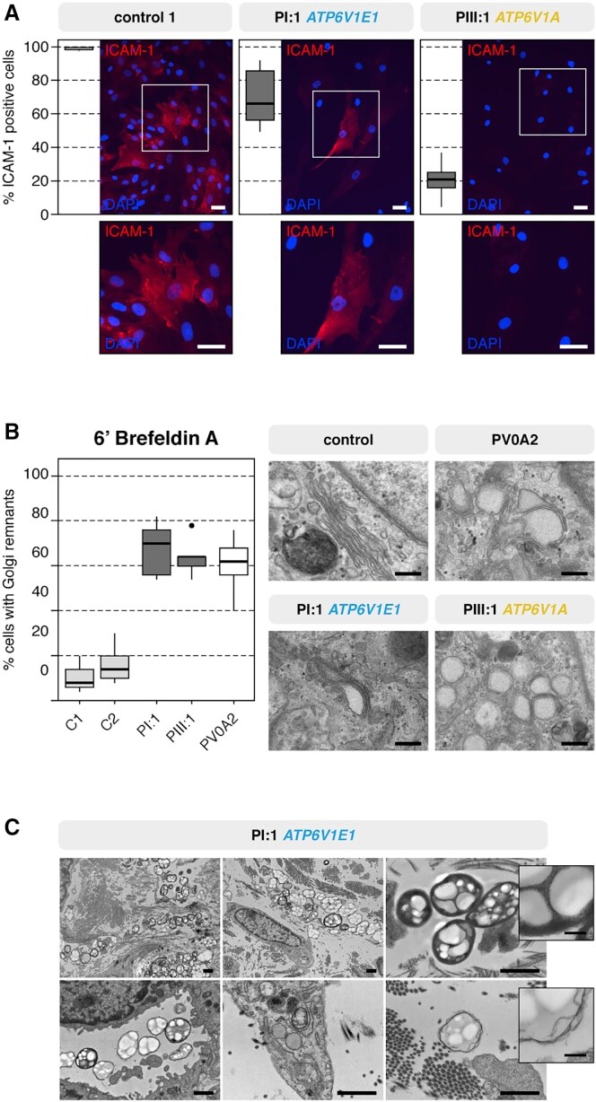 Icam Antibody Ma