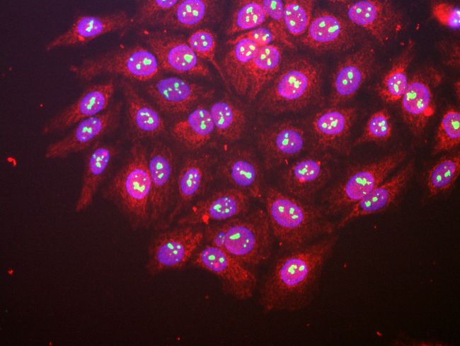 pin1 Primary Antibodies