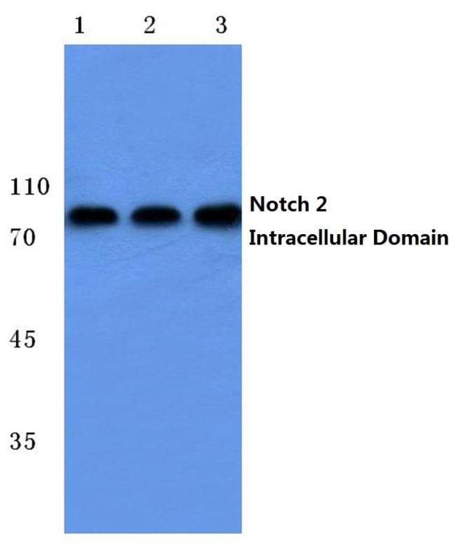 Cytotec Induction