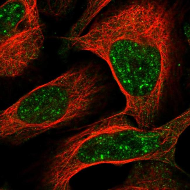 c1orf194 Primary Antibodies