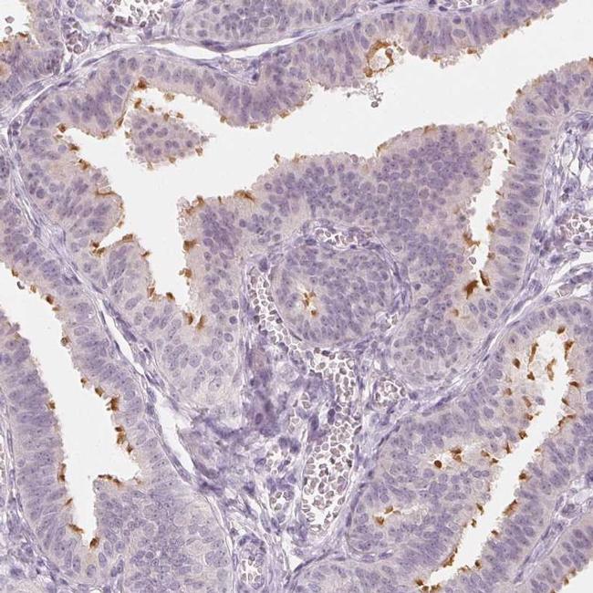 c1orf194 Primary Antibodies