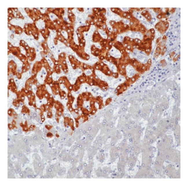 Lab Vision™ Hepatitis B Virus Surface Antigen (HBVsAg) Ab-1, Mouse ...