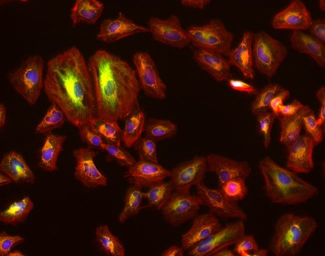Fluorescence image of HeLa cells with EVOS M7000 microscope