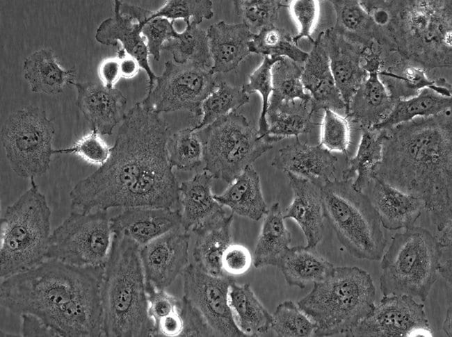 40X phase-contrast image of HeLa calls with EVOS M7000 microscope