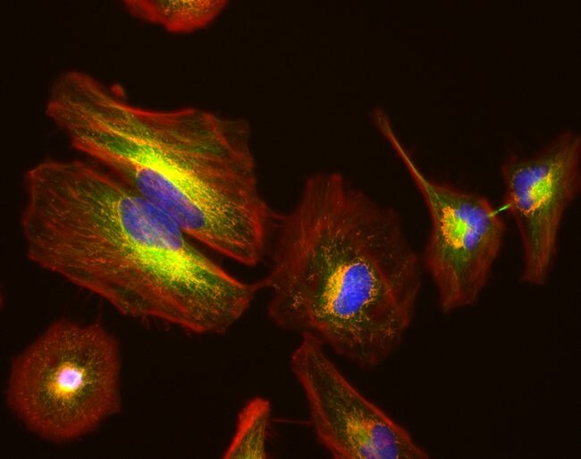 40X fluorescence image of HeLa cells with EVOS M7000 microscope