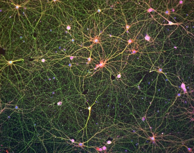 Mouse cortical neurons mounted in Prolong Glass and imaged with EVOS FL Auto 2