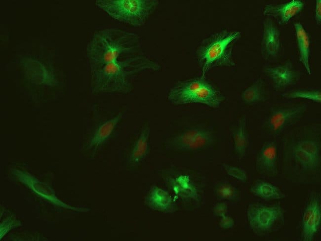 HeLa cells expressing GFP and RFP captured on EVOS M5000