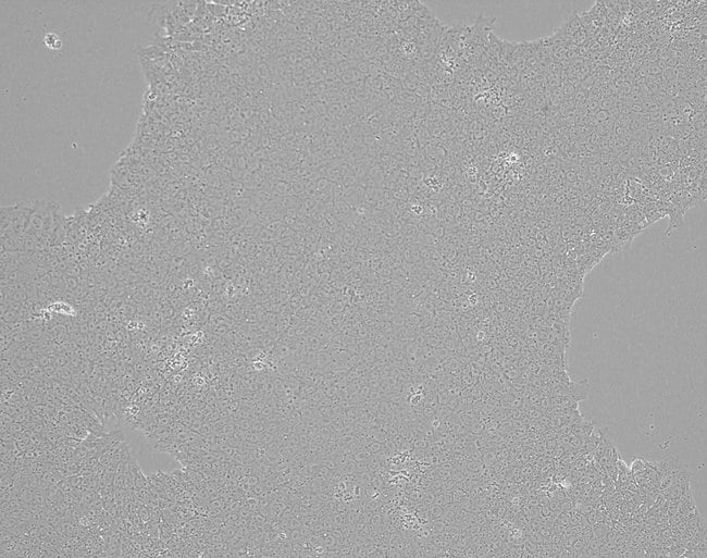 iPSC imaged on EVOS M7000 microscope