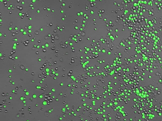 Assessing cell viability with fluorescence microscopy