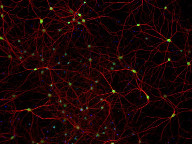 HuC/D and MAP2 staining of primary rat cortex neurons