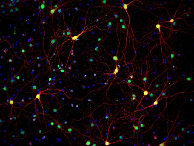 HuC/D and MAP2 staining of primary rat cortex neurons