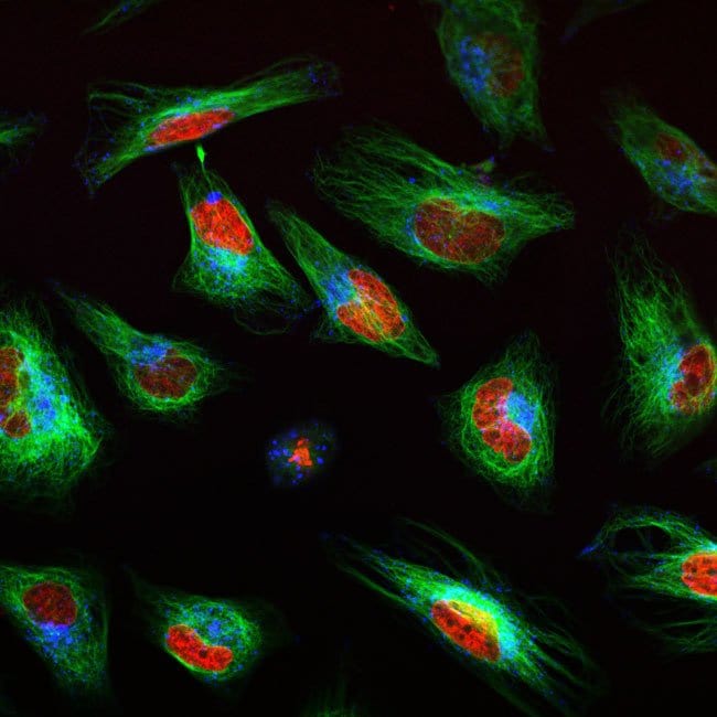 Multiplex image of  live HeLa cells