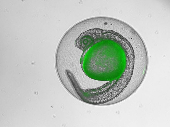 Zebrafish embryo  imaged with EVOS M5000 