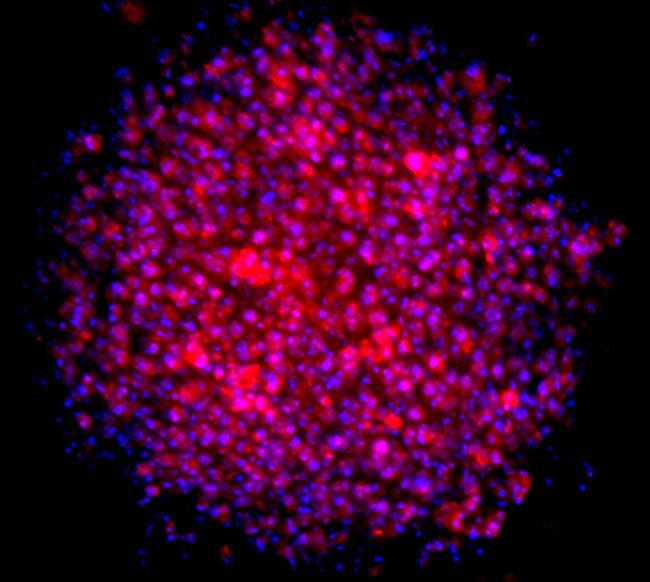 HeLa spheroid staining with CellMask Orange Actin Tracking Stain