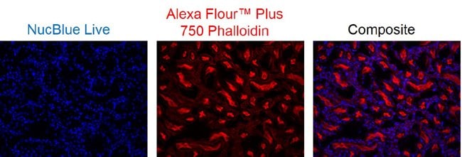 Mouse kidney labeled with Alexa Fluor Plus 750 Phalloidin