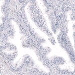 https://www.dev3.thermofisher.com/content/dam/LifeTech/Images/Brands/search/default-brand.jpg