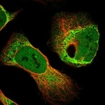 https://www.dev3.thermofisher.com/content/dam/LifeTech/Images/Brands/search/default-brand.jpg