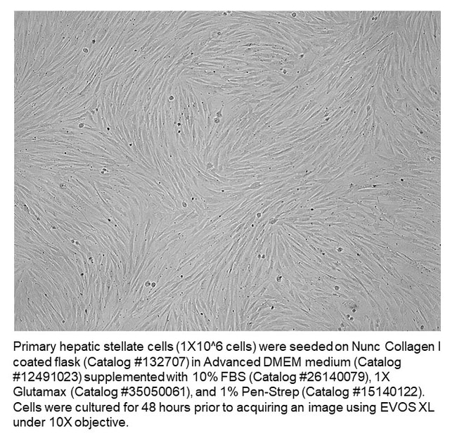 1 µm Membrane Pore Size DISCOVERY LABWARE 354482 Polyethylene Terephthalate Collagen I Cellware Insert in 2 x 24 Well Plates 