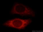 https://www.dev3.thermofisher.com/content/dam/LifeTech/Images/Brands/search/default-brand.jpg