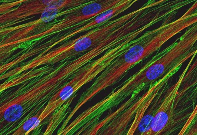 Stained and Fixed Neonatal Human Dermal Fibroblasts