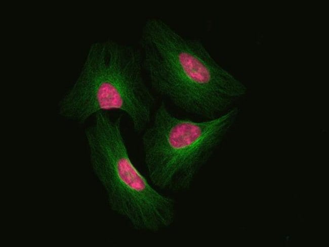 HeLa cells fixed and permeabilized using the Image-iT® Fixation/Permeabilization kit.