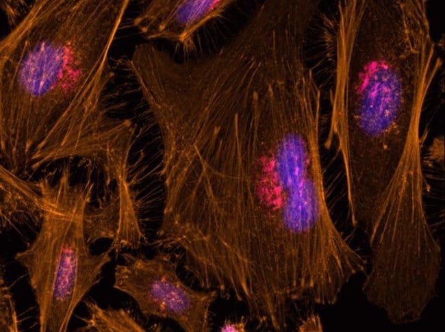 HeLa Cells Fixed and Permeabilized Using the Image-iT® Fixation/Permeabilization Kit (R37602)