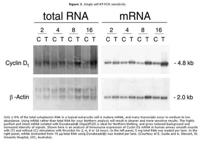 Single-cell RT-PCR sensitivity.