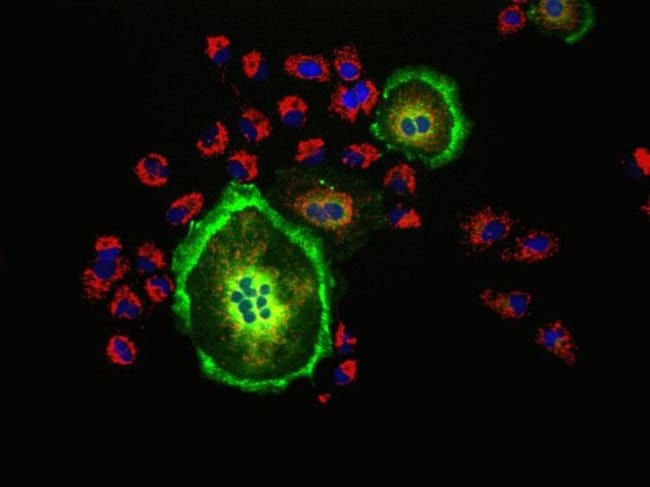 Sample Image (Early Endosomes and Mitochondria):