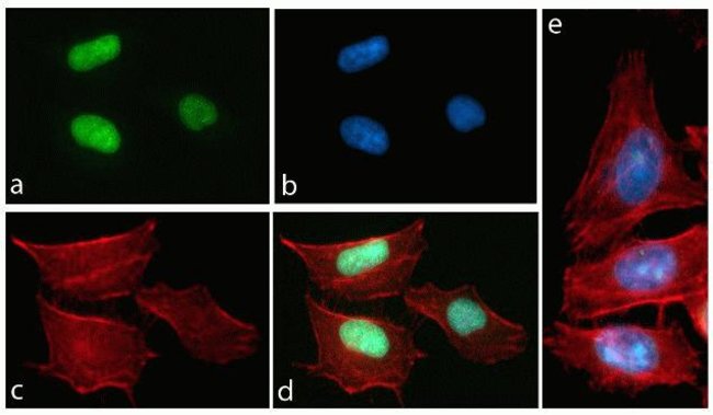 Immunocytochemistry analysis with Tau [pT231] ABfinity™ Recombinant Rabbit Monoclonal Antibody.
