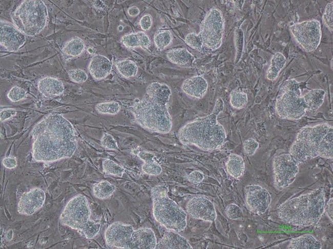 C57bl 6 Mouse Embryonic Fibroblasts Irradiated