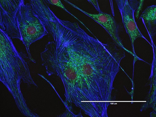 Mitochondria and cytoskeleton imaged on EVOS® FL Auto imaging system