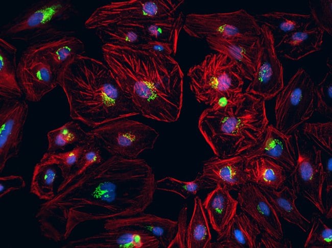 HeLa cell Golgi and cytoskeleton imaged using the EVOS® FL Auto imaging system