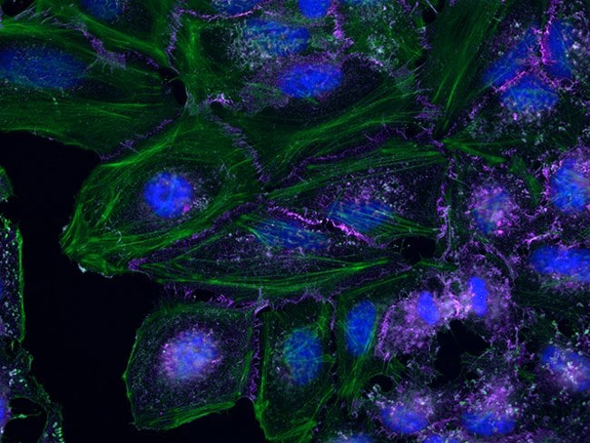 Qdot®-based staining of B-catenin in HeLa cells imaged using the EVOS® FL Auto imaging system