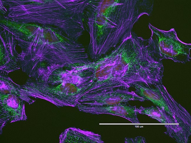 Cytoskeleton and mitochondria in HeLa cells imaged on EVOS® FL Auto imaging system