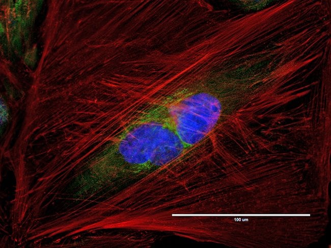 Golgi and actin in HeLa cells imaged on EVOS® FL Auto imaging system