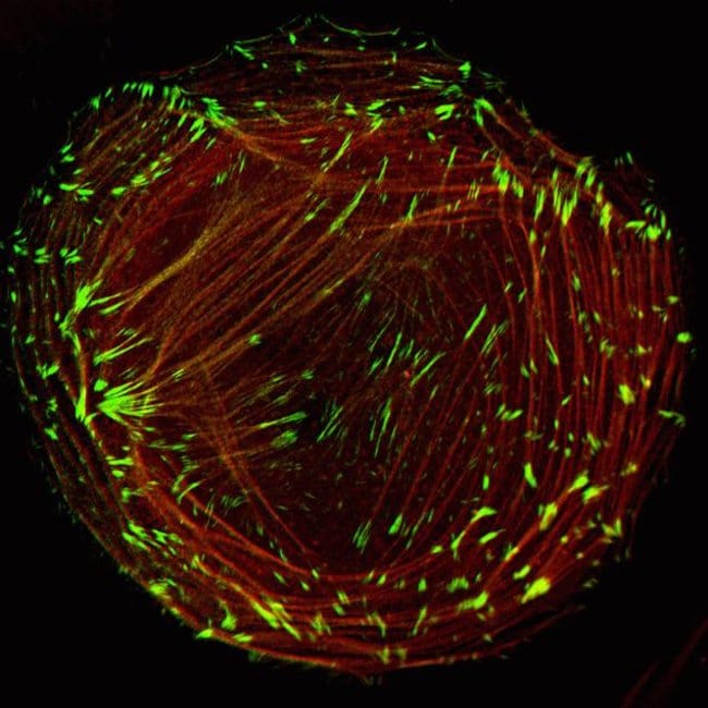 Human epidermal keratinocytes, neonatal, (HEKn) were co-transduced with CellLight® Actin-RFP and CellLight® Talin-GFP and imaged on a Zeiss LSM confocal microscope after over night incubation.