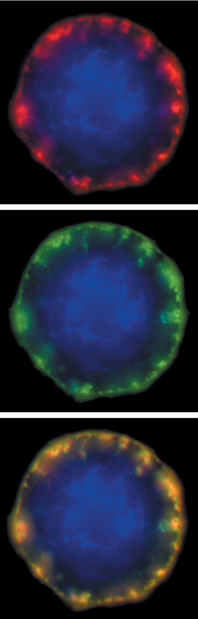 A J774 mouse macrophage cell stained with BODIPY® FL ganglioside GM1 (B13950) and Alexa Fluor® 555 dye–labeled cholera toxin subunit B.