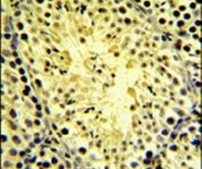 DGKK Polyclonal Antibody