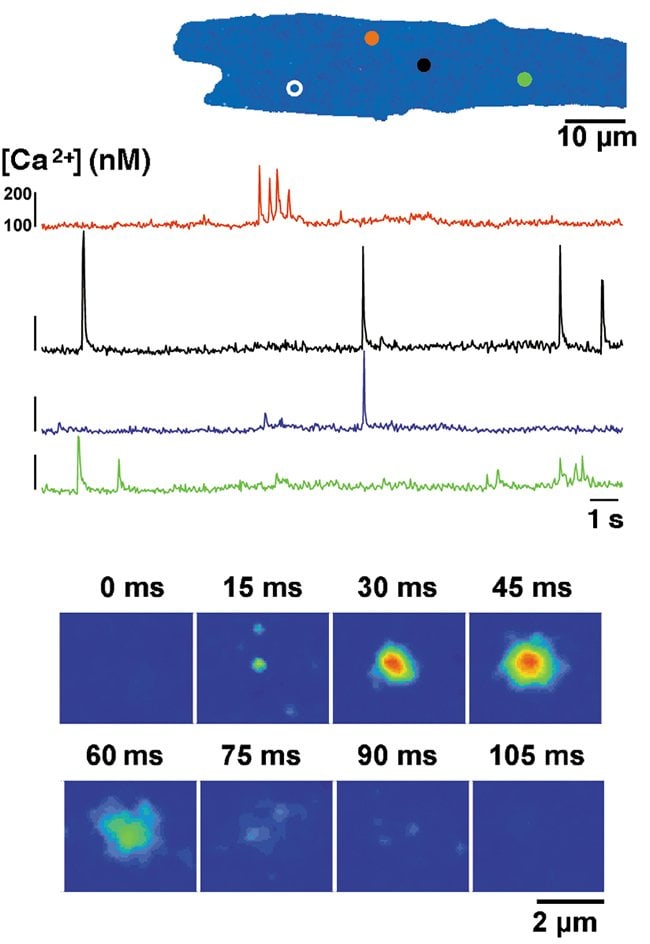 Fast confocal recording of spontaneous Ca<sup>2+</sup> sparks in a rat ventricular myocyte.