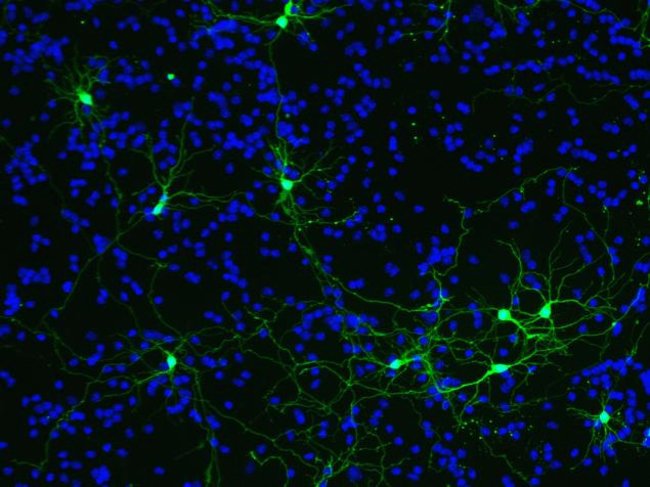 Granule neurons were transduced with an untargeted GFP construct, BacMam GFP transduction control (Cat.no. B10383).  Following an overnight incubation nuclei were counter-stained using NucBlue® Live cell stain and imaged on the FLoid® Cell Imaging Station (Cat.no. 4471136).