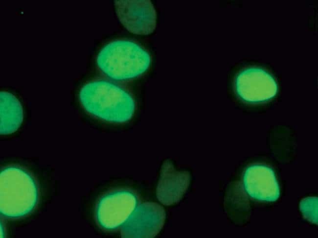 Live cell imaging with CellLight™ reagents.