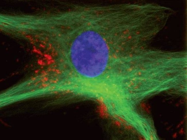 Live cell imaging with CellLight™ reagents.