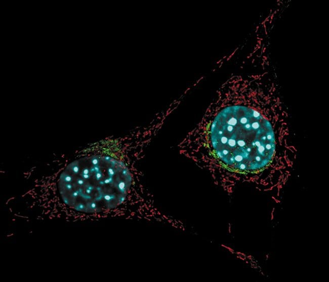 Live NIH 3T3 cells labeled with probes for mitochondria, Golgi and the nucleus.