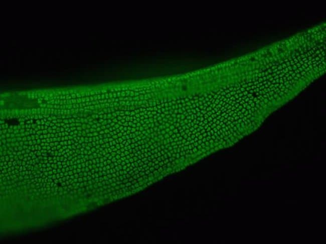 A stand of moss shows green autofluorescence when imaged on the  FLoid® Cell Imaging Station (Cat.no. 4471136).