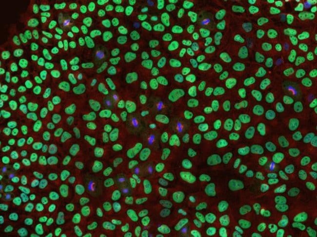 Human iPSC staining using mouse anti beta-tubulin monoclonal antibody.
