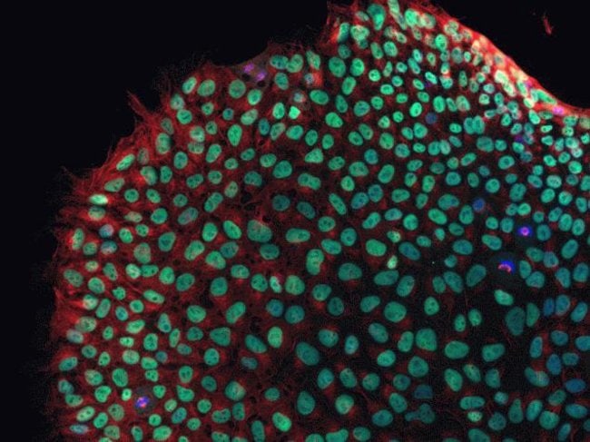 Human iPSC staining using mouse anti beta-tubulin monoclonal antibody.