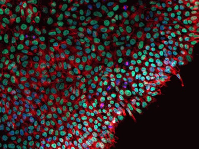 Human iPSC staining using Mouse Anti Beta-Tubulin Monoclonal Antibody.
