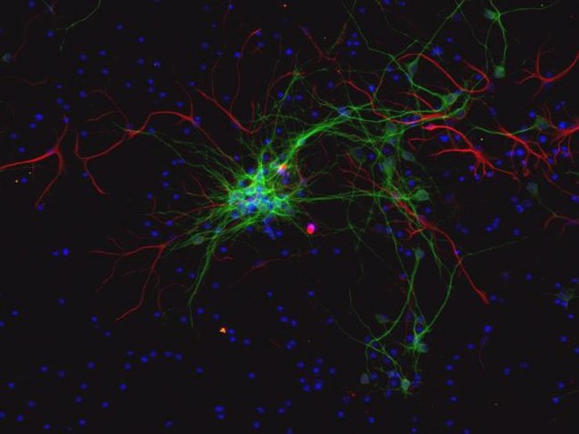 Culture of glial cells expressing GFAP-mCherry-RFP (glial fibrillary acidic protein) and neurons expressing MAP4-GFP.  Following nuclear staining with DAPI (Cat.nos. D1306, D3571, D21490, R37606) three-color fluorescence images were acquired on the  FLoid® Cell Imaging Station (Cat.no. 4471136).