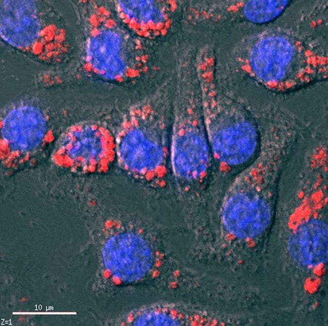 Phagocytosis in  MMM Cells using pHrodo™ Red E. coli BioParticles® Conjugate® (Catalog # P35361)